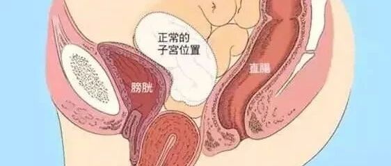 阴道里脱出块“肉”！