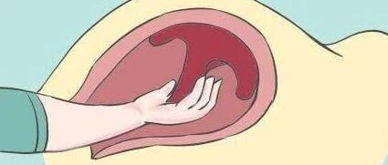 顺产的终极疼痛：手剥胎盘是分娩痛的10倍！