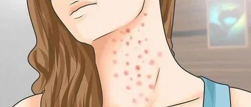 你最关心的41个HPV感染及疫苗注射问题