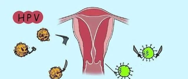 到底查TCT还是HPV？一分钟教你读懂“宫颈癌”筛查报告！