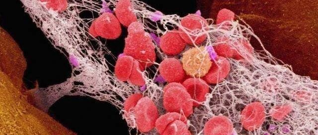 典藏版丨血压、血糖、血脂、尿酸标准对照表，忌口清单全都有！