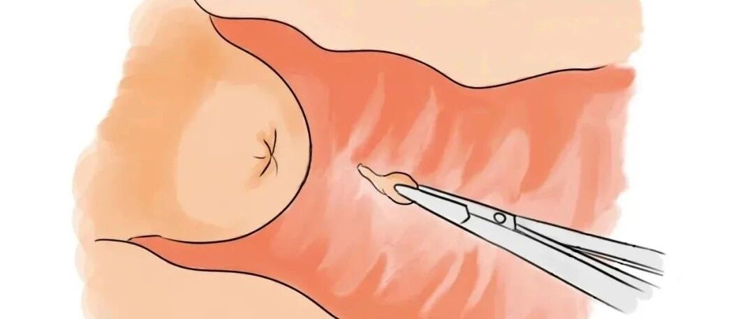 2020年度盘“坑”：这些妇科的“坑”你过踩几个？