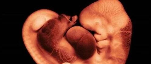 把性激素六项掰碎揉烂地分析完，原来这么简单！