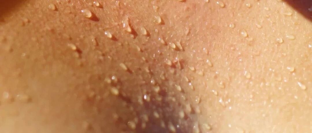 “产后发汗”发的不是汗，是命！千万别去做！