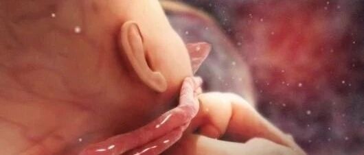 确诊“小龙人”，9个月准妈妈含泪引产......