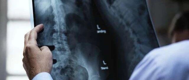 剖宫产后出现双下肢麻木，医院起诉患者返还42万遭反诉，最终反赔106万，到底发生了什么？