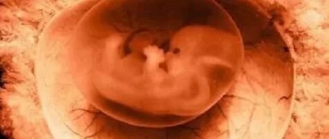 为什么现在胎停的人越来越多？如何备孕？