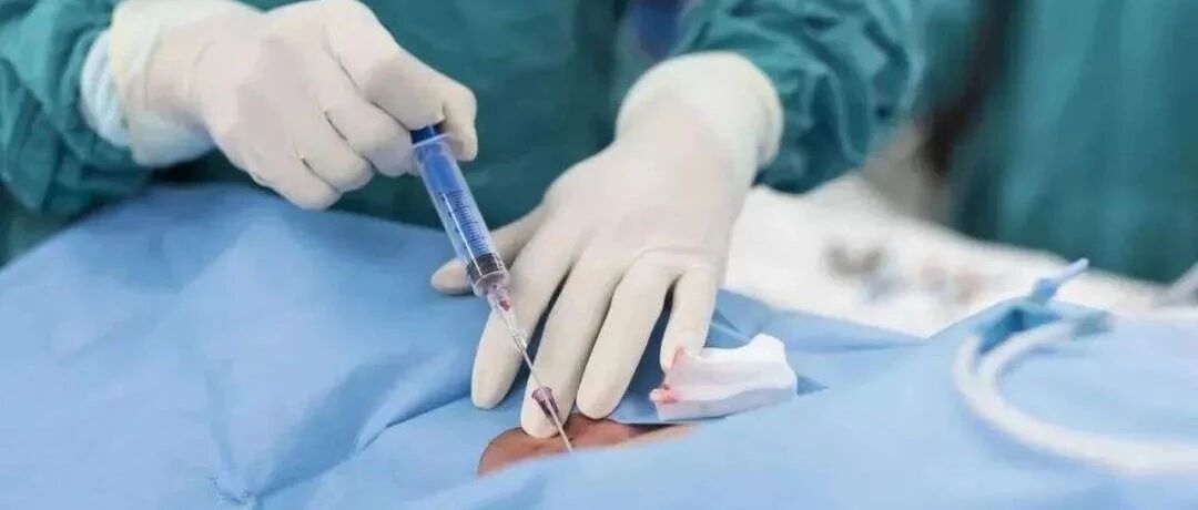 为什么无痛分娩那么好，普及率却不高？9个问题全搞清