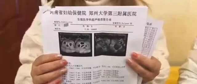 女子怀上八胞胎，促排卵药物别乱用