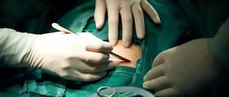 剖7层缝7层，100张剖宫产过程照，让你了解生为人母的不易！