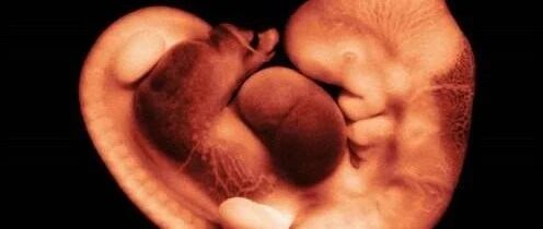 胎停越来越多，原因何在？