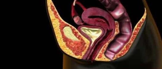 卵巢：人还未老，她已垂暮