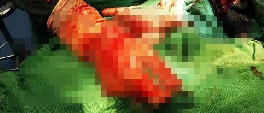 做手术，医生为什么要换内裤？