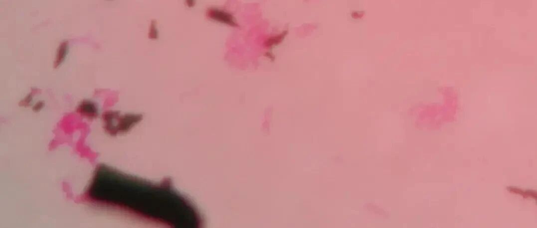 喝了小区门口买的“现挤鲜奶”，他足足烧了5天！