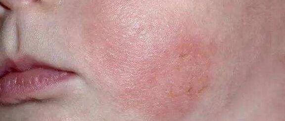 一杯芒果汁差点要了孩子的命！年轻爸妈60分钟跑赢死神！