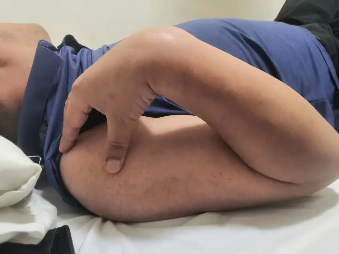 肘关节康复器怎么用“能屈能伸”——创伤后肘关节僵硬，这样治疗效果佳！_https://www.jmylbn.com_新闻资讯_第8张