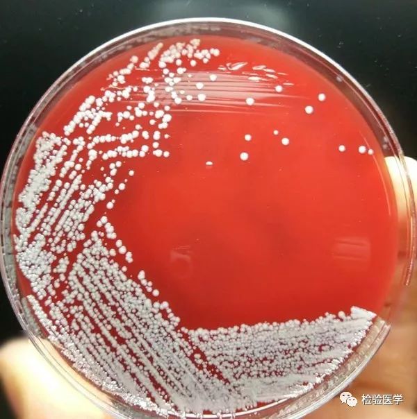 溶血葡萄球菌图片