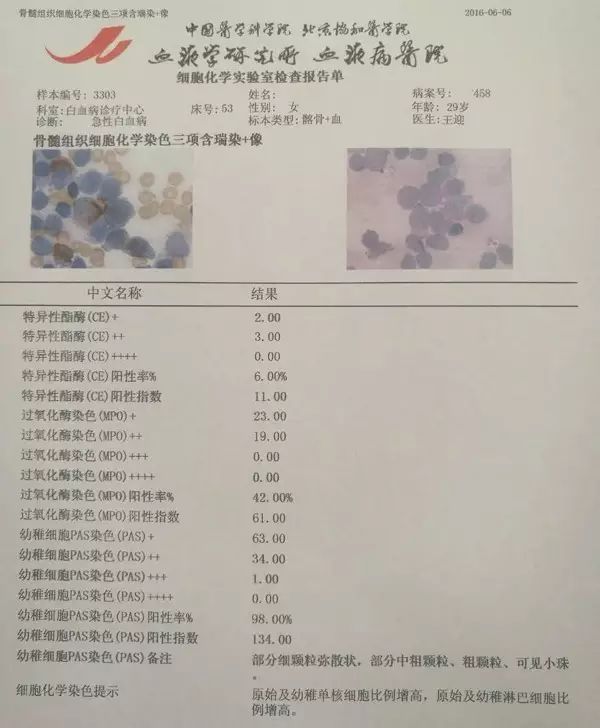 雙系列急性白血病,你診斷對了嗎?