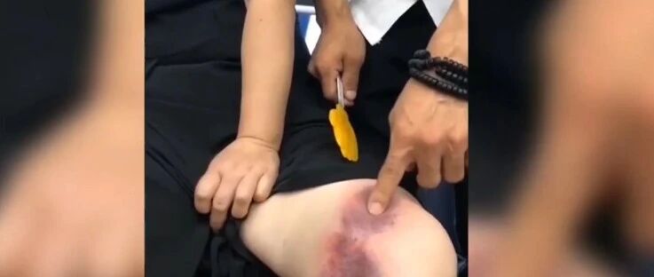 老人沉迷“古法”机构教学，拿棍子狂打自己就能治百病？