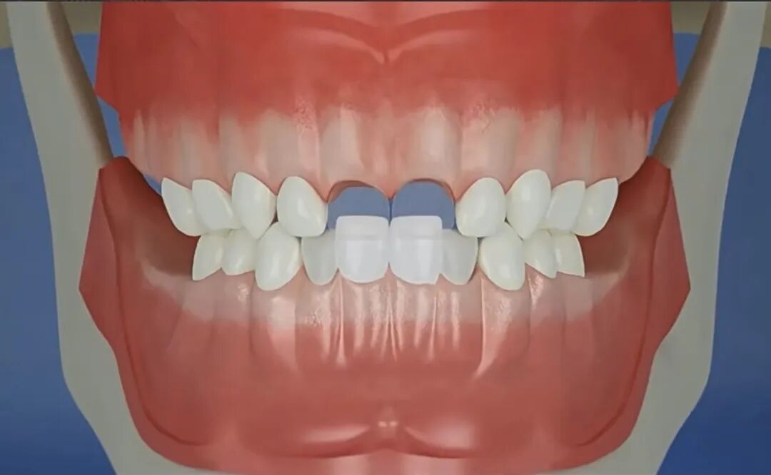 曲面断层片怎么看换牙与身高有关吗？关于孩子换牙的所有疑问一篇说清_https://www.jmylbn.com_新闻资讯_第19张