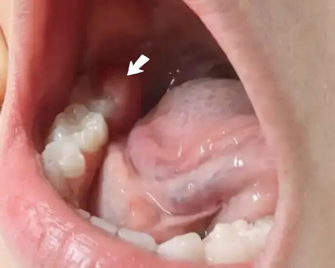 曲面断层片怎么看换牙与身高有关吗？关于孩子换牙的所有疑问一篇说清_https://www.jmylbn.com_新闻资讯_第23张