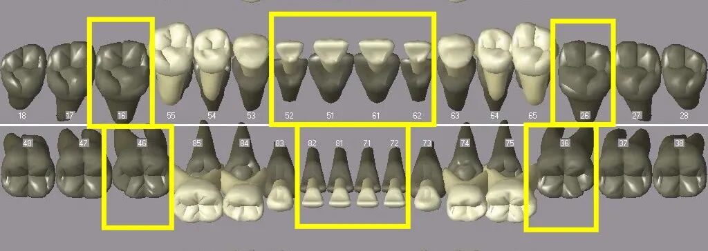 曲面断层片怎么看换牙与身高有关吗？关于孩子换牙的所有疑问一篇说清_https://www.jmylbn.com_新闻资讯_第5张