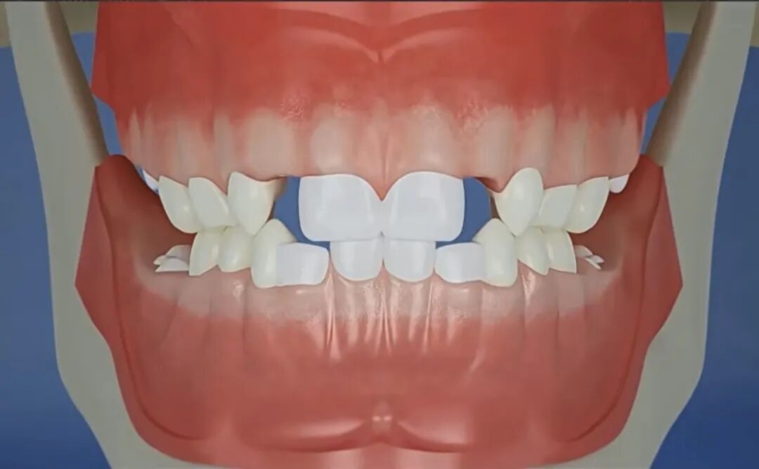 曲面断层片怎么看换牙与身高有关吗？关于孩子换牙的所有疑问一篇说清_https://www.jmylbn.com_新闻资讯_第13张