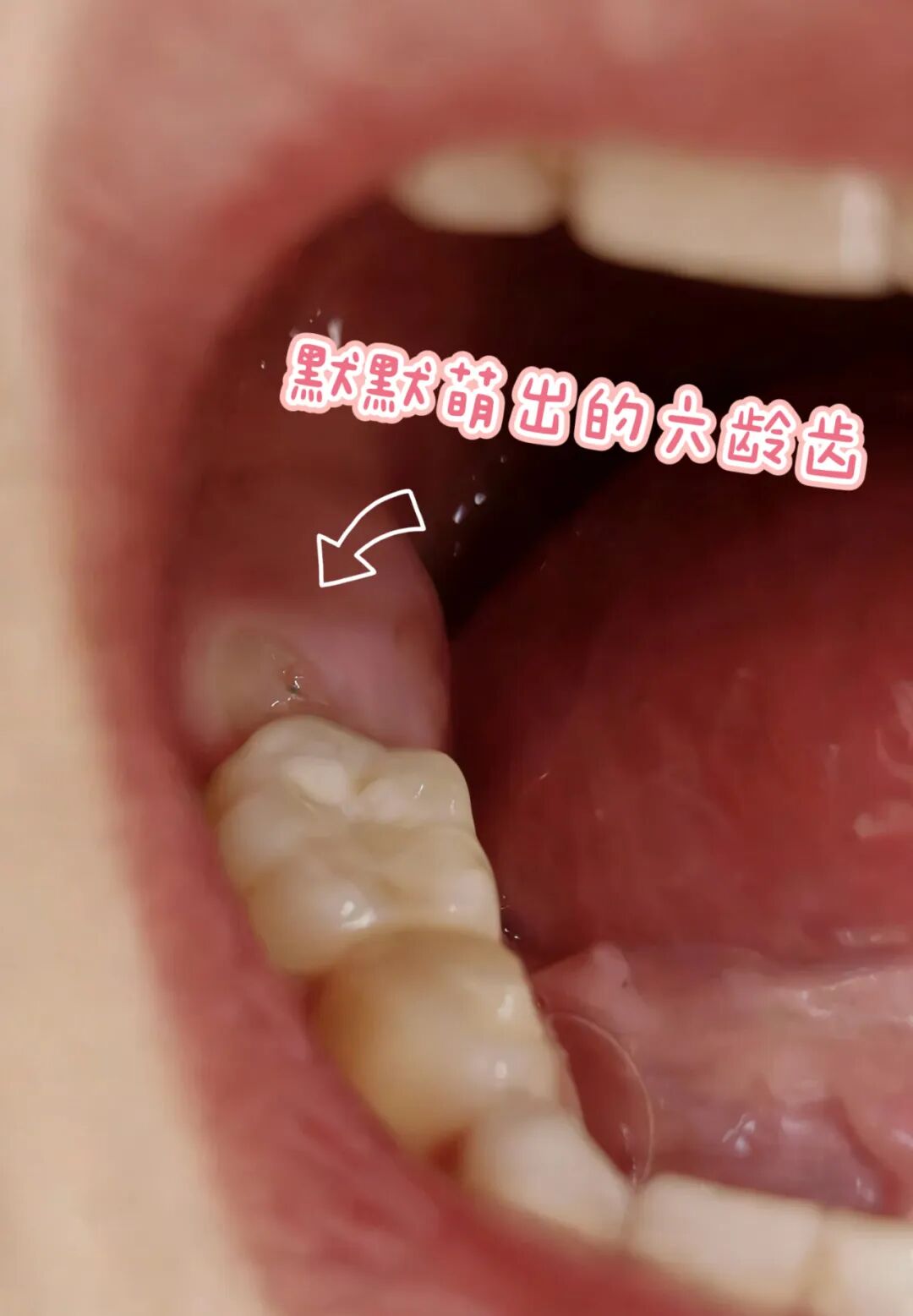 曲面断层片怎么看换牙与身高有关吗？关于孩子换牙的所有疑问一篇说清_https://www.jmylbn.com_新闻资讯_第21张