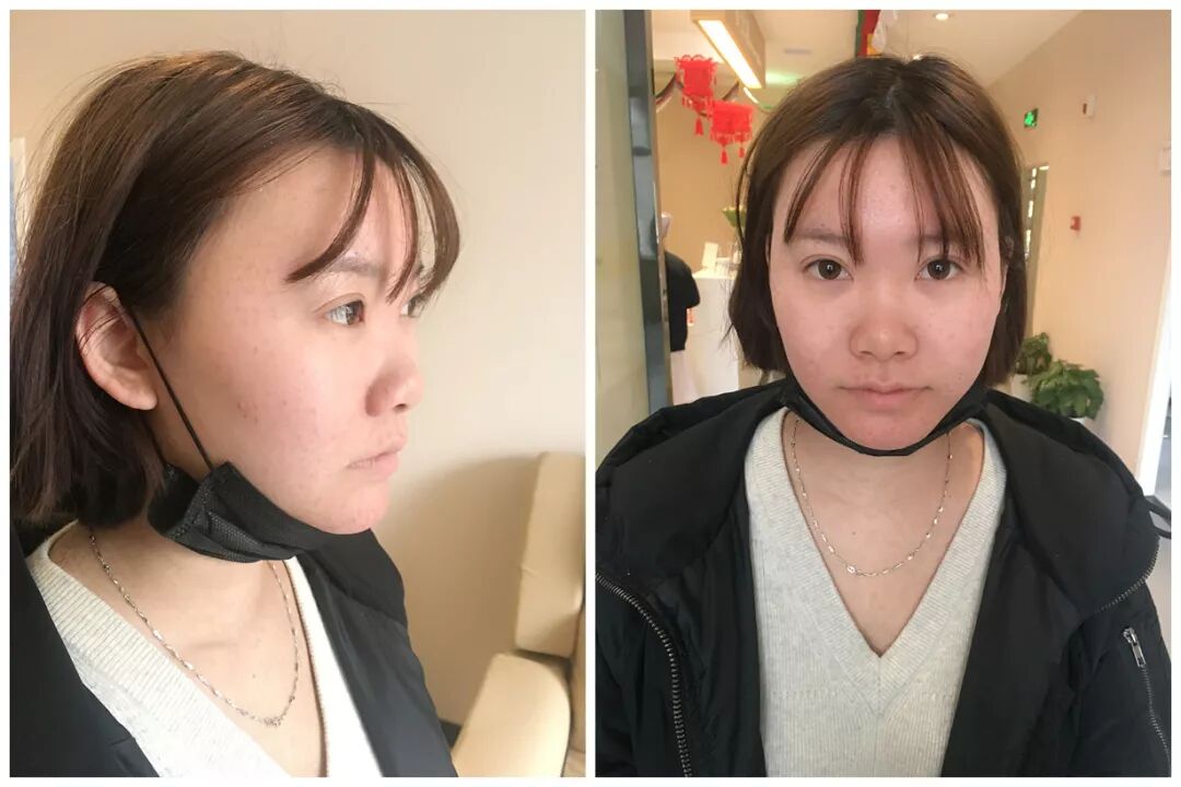 又短又扁的蒜头鼻妹子告诉你:土妞和仙女最大的区别