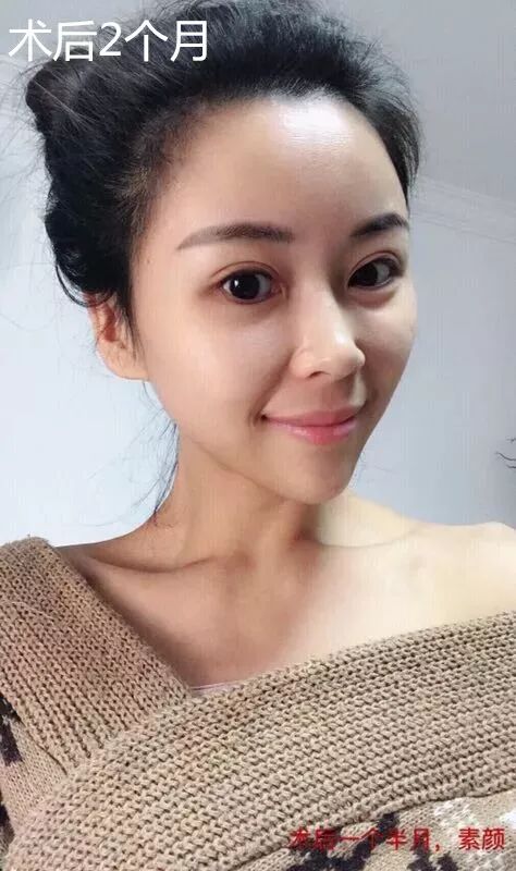 心形脸甜美少女的标配蛇精脸拜拜