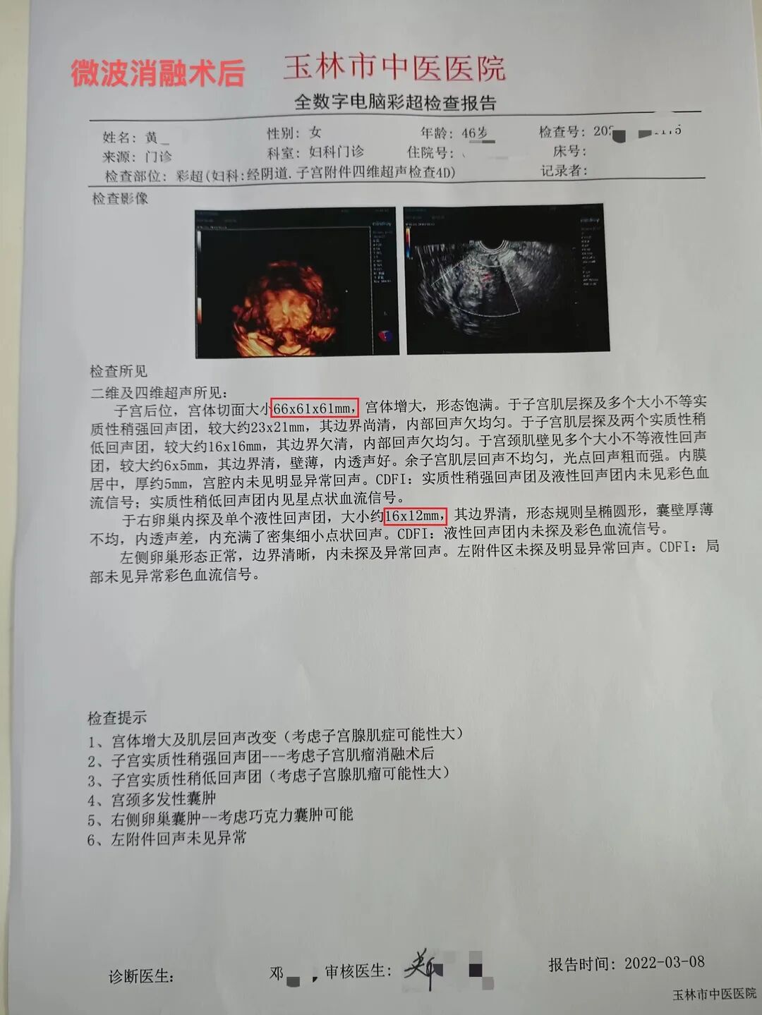 妇科微波怎么操作【新技术】关爱子宫，一根小小微波消融针让子宫腺肌病患者免受切除子宫!_https://www.jmylbn.com_新闻资讯_第5张