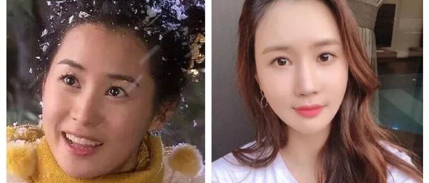 打针打到脸僵掉？娱乐圈“缺心眼”女星，有人只为鲜肉老公一句话