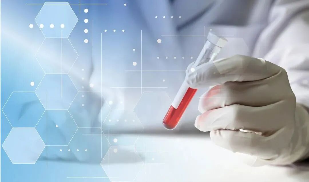 什么是血液净化？这4大征兆提示你的“血液垃圾”已过载！