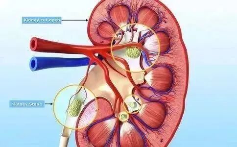 什么是血液净化？这4大征兆提示你的“血液垃圾”已过载！