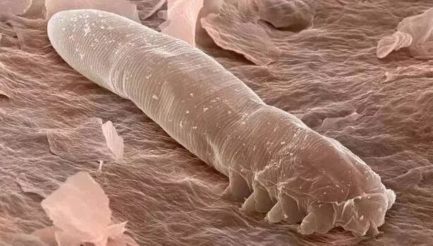 提醒眼睛瘙痒不适眼干眼红眼屎变多小心可能是睫毛感染了螨虫