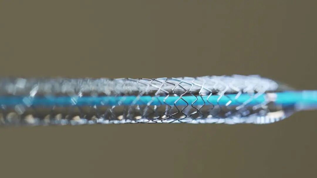 球囊怎么取出来血管里的斑块能取出来吗？心脏支架放进去，斑块去哪了？药物球囊和支架，哪个更好？_https://www.jmylbn.com_新闻资讯_第7张