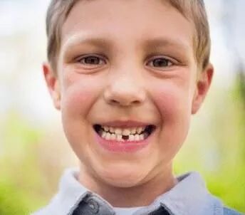 开学了，你家小孩蛀牙没有？