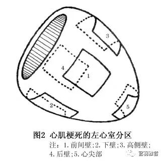 心电图mm单位怎么读12导、15导、18导连接示意图及心脏各壁超声解剖位置与心电图导联对应关系_https://www.jmylbn.com_新闻资讯_第8张