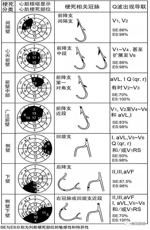 心电图mm单位怎么读12导、15导、18导连接示意图及心脏各壁超声解剖位置与心电图导联对应关系_https://www.jmylbn.com_新闻资讯_第13张