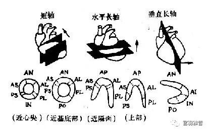 心电图mm单位怎么读12导、15导、18导连接示意图及心脏各壁超声解剖位置与心电图导联对应关系_https://www.jmylbn.com_新闻资讯_第9张