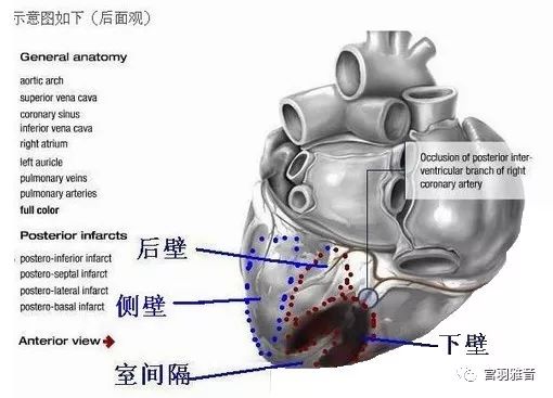 心电图mm单位怎么读12导、15导、18导连接示意图及心脏各壁超声解剖位置与心电图导联对应关系_https://www.jmylbn.com_新闻资讯_第7张