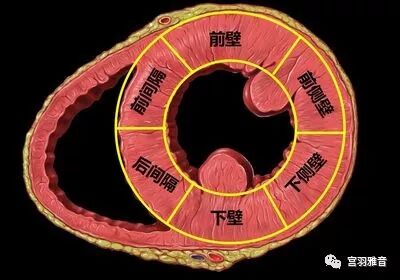 心电图mm单位怎么读12导、15导、18导连接示意图及心脏各壁超声解剖位置与心电图导联对应关系_https://www.jmylbn.com_新闻资讯_第10张