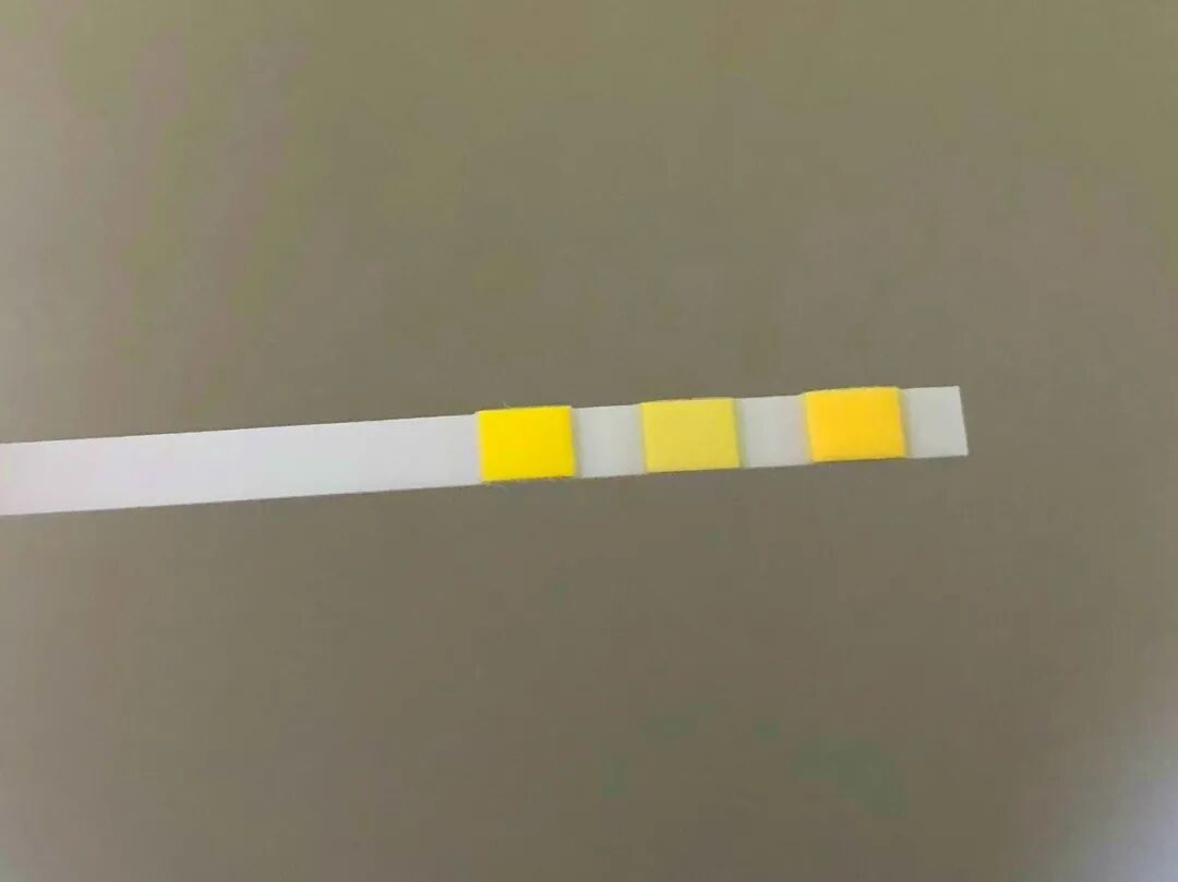 糖耐不检查医院给生孩子吗_糖耐没做医院收产妇吗_没做糖耐医院不给接生吗