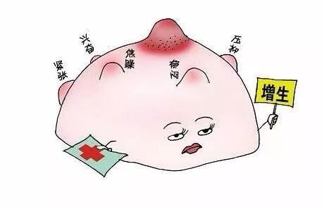 九成乳腺增生其实只需要护理按摩！