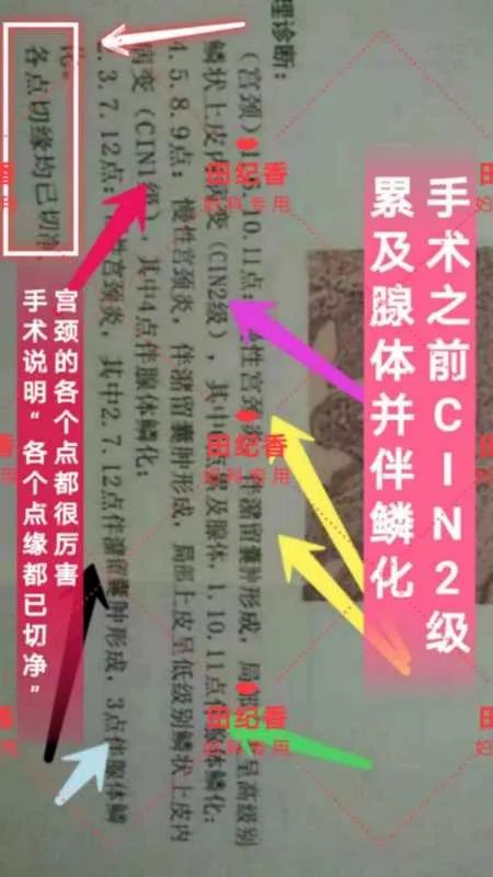 感染了HPV，癌前病变怎么办？