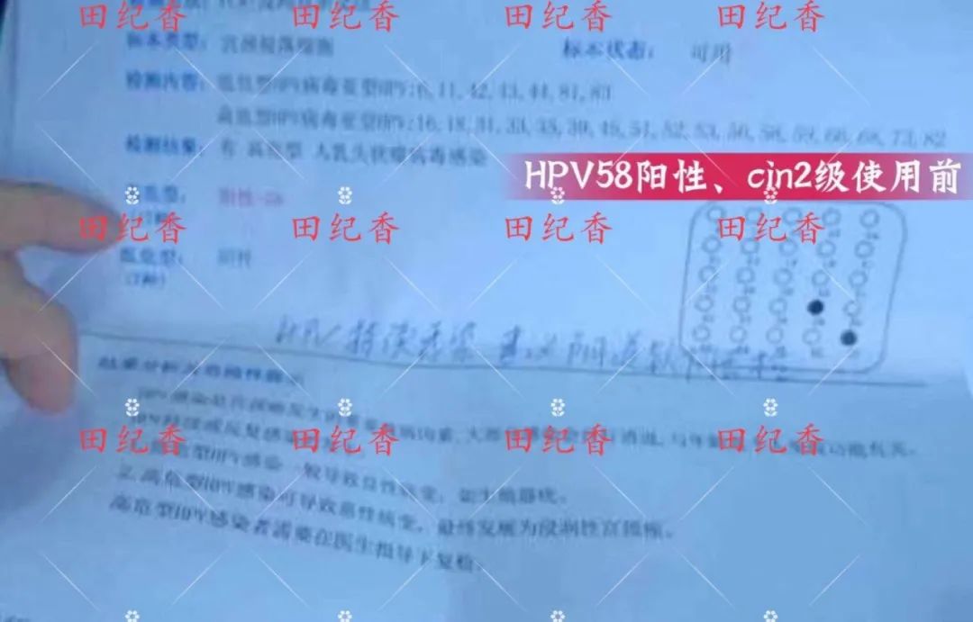 感染了HPV，癌前病变怎么办？