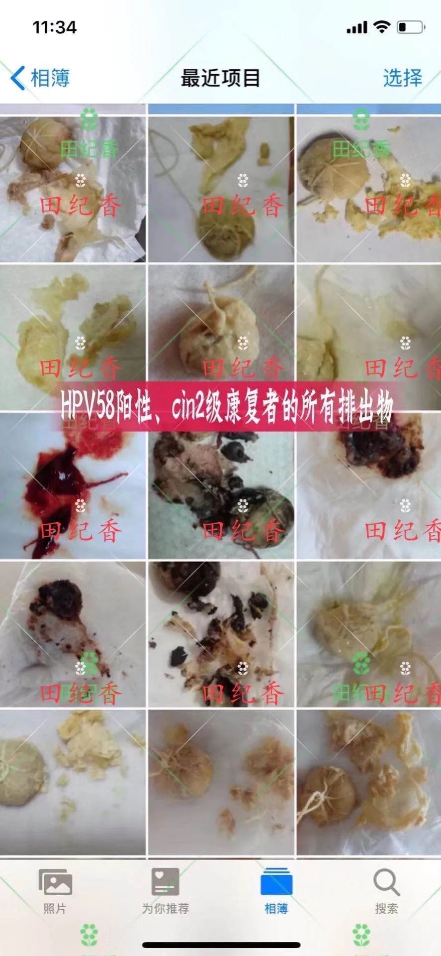 感染了HPV，癌前病变怎么办？