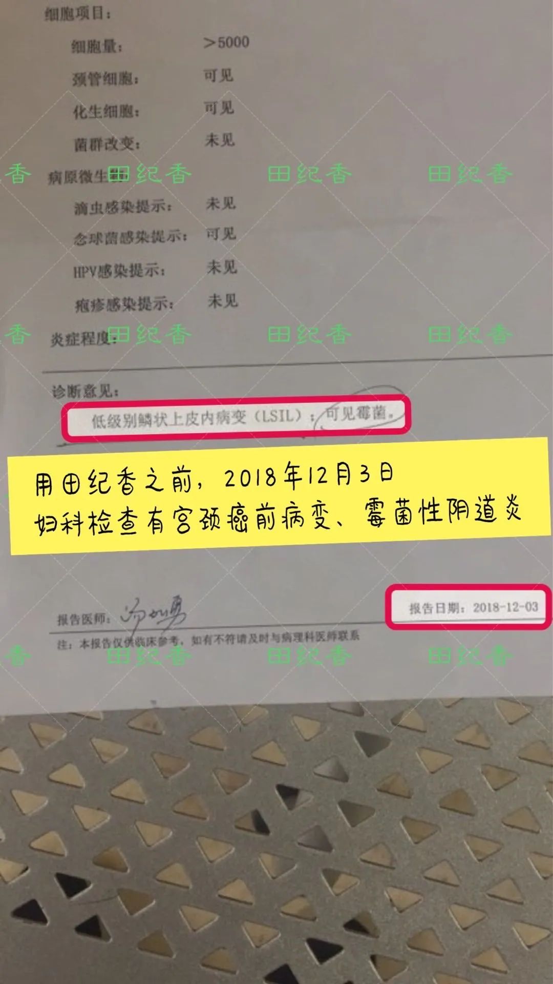 感染了HPV，癌前病变怎么办？