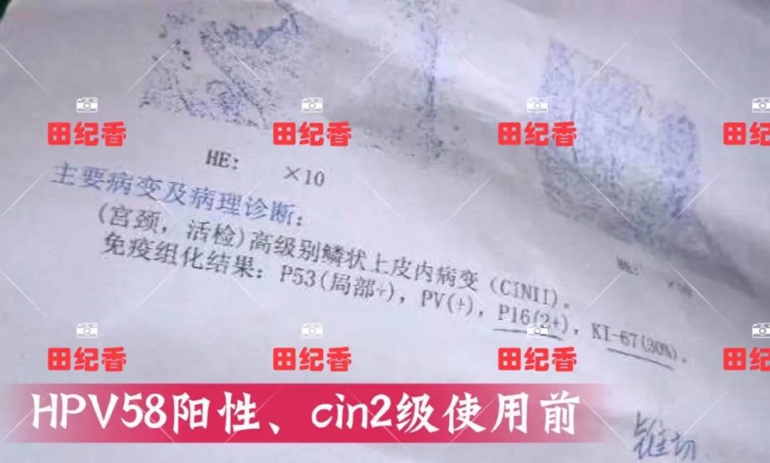 感染了HPV，癌前病变怎么办？