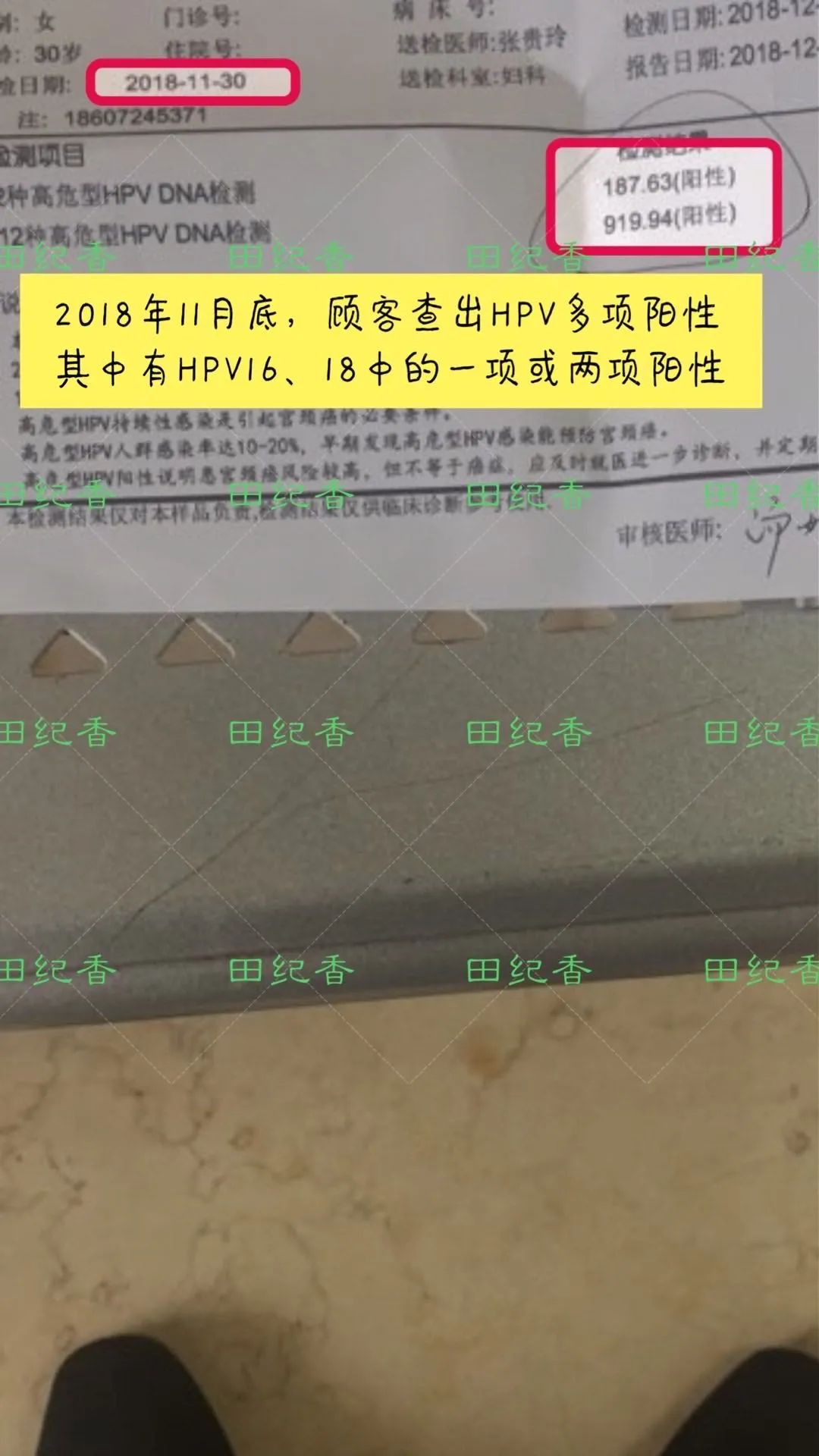 感染了HPV，癌前病变怎么办？